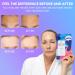 MISS SPA Forehead Silicone Anti-Wrinkle Patch - Reusable 20x | Hydrating & Smoothing Overnight Anti-Aging Face Patches - Dermatologist Tested - Buy Online on GoSupps.com