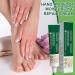 Foot Cream - Nourishing Balm 20g | Hand Lotion For Sensitive Feet Chapped Skin Daily Use Shower Women Men - Buy Online on GoSupps.com