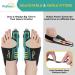 Puikos Bunion Corrector for Men & Women | Big Toe Splint & Hallux Valgus Relief | Adjustable Toe Straightener & Separator for Day/Night Use - Buy Online on GoSupps.com
