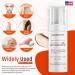 Mesoderm RX Anti Sun Spots 50ml - Targeted Solution for Brighter Skin - Buy Online on GoSupps.com