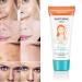 Crema Aclarante para Manchas en Cara, Axilas, Cuello y Entrepierna - Buy Online on GoSupps.com
