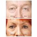 ROX Eye Lifting - TV Rox Anti Eye Wrinkle Booster | International Shipping Available - Buy Online on GoSupps.com