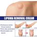 Lipoma Removal Cream Lipoma Elimination Cream Natural Herbal Lipoma Soothing Cream Effective Lipoma Care Cream Cream Relieve Varicose Veins Instant Tumor Removal Cream Skin Anti Swelling Cream - Buy Online on GoSupps.com