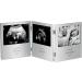VonHaus Triple Sonogram Picture Frame - Preserve Ultrasound and Baby Photos - Buy Online on GoSupps.com