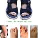 Niupiour Fabric Hammer Toe Wraps - 8 Pack Toe Bandages Protectors & Braces for Overlapping, Crooked, Curled, and Bent Toes - Toe Splints & Separators for Broken Toes - Buy Online on GoSupps.com