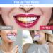 Professional Teeth Whitening Kit - Gel Pen Strips 32X LED Light Charging Case & Desensitizing Gel - Brighten Your Smile Anywhere - Buy Online on GoSupps.com