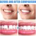 Buy 2 Pairs Instant Veneer Prostheses - Comfortable & Natural Fake Teeth for Men & Women | Artificial Teeth Solutions - Buy Online on GoSupps.com