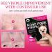 90 Pcs Nose Blackhead Remover Strips - Deep Cleansing Pore Strips for Women - Buy Online on GoSupps.com