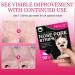AGETITY Nose Strips 90 Pcs - Blackhead Remover for Women - Deep Cleansing Pore Strips - Buy Online on GoSupps.com