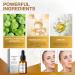 Tranexamic Acid Serum Tranexamic Acid Skin Brightening Serum Dark Spot Correcting Glow Serum Moisturiser For Acne Prone Skin with Hyaluronic Acid Arbutin Hyperpigmentation and Even Skin Tone - Buy Online on GoSupps.com