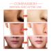 Buy 5 In 1 Facial Serum - 30% Vitamin C Anti-Aging Hydrating Serum with Niacinamide & Hyaluronic Acid - 1.05 Fl.oz (2PCS) - Wrinkle Reduction & Collagen Boost - Buy Online on GoSupps.com