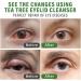 SCOBUTY Tea Tree Eyelid Gel Cleanser - Soothing Formula for Dry Eye & Eyelid Irritation | Vitamin B5 & Hyaluronic Acid - 60 ml - Buy Online on GoSupps.com