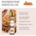 Aoruilia 10ml Frankincense Essential Oils - 100% Pure Natural Frankincense Oil for Diffuser for Home Aromatherapy Relax Spa Yoga Soaps & Candles Making Frankincense 10 ml (Pack of 1) - Buy Online on GoSupps.com