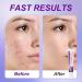 Azelaic Acid for Face Balance Skin Tone & Cleanse Pores Azelaic Acid Serum with 12% Acido Azelaico-Relieve Acne Blackhead & Redness Premium Skin Care 20g - Buy Online on GoSupps.com
