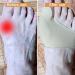 LINXIU Hallux Valgus Splint Socks - Toe Spreader & Hammer Toe Pain Relief | 1 Pair - International Shipping - Buy Online on GoSupps.com
