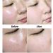 BEALIFE Portable Oil Absorbing Volcanic Face Roller for Flawless Makeup for Men and Women Pink - Buy Online on GoSupps.com