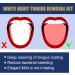 Fresh Mint Tongue Cleaner Gel Set - Reduce Bad Breath & Maintain Mouth Health | Tongue Scraper with Brush - 50g - Buy Online on GoSupps.com