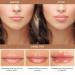 Lip Plumper Device | Manual Lip Enhancer for Natural Fuller Lips | Self-Suction Tool for Women | Perfect Girlfriend Gift - Buy Online on GoSupps.com