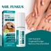 2 IN 1 Nail Fungus Treatment Oil - Fast Relief for Toenail Paronychia & Fungal Infections - Buy Online on GoSupps.com