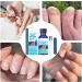 S rum de soin des ongles renforce et nourrit 30 ml traitement contre l s champignons des ongl s d s pieds soin d s ongles contre les champignons r duit la d coloration les cuticules s ch - Buy Online on GoSupps.com