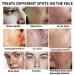 Dark Spot Remover Serum for Face with Vitamin C, Retinol, Salicylic Acid & More - Hyperpigmentation & Acne Scar Treatment - Buy Online on GoSupps.com