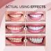 SP-4 Probiotic Ultra Whitening Toothpaste - Brighten Your Smile & Freshen Breath (1PC) - International Shipping Available - Buy Online on GoSupps.com