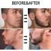 Beard Roller for Growth Derma Roller 0.5MM 540 Titanium Needles Microneedle Tool for Face Body Skin Care Beard Hair Growth (0.5MM) - Buy Online on GoSupps.com