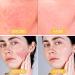 Buy SPF 50 Mineral Sunscreen Setting Powder - Oil Control Matte Finish Long Lasting - Lightweight Concealer Brush - International Shipping - Buy Online on GoSupps.com