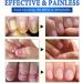 Nail Fungus Treatment for Toenail - 7 Day Fungal Nail Treatment for Toenails Extra Strong - Fungal Nail Treatment - Toenail Fungus Treatment for Thickening Yellow-Brown Discoloration Ragginess 10ML - Buy Online on GoSupps.com