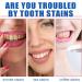 SP-8 Ultra Whitening Toothpaste - Probiotic Brightening & Fresh Breath - 2PCS - 240g for Stain Removal - Buy Online on GoSupps.com