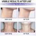 Neck Tightening Cream Duo - Firming & Lifting Sagging Skin, Reduce Wrinkles & Fine Lines - 40g x 2 - Buy Online on GoSupps.com