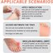 10pcs Gel Toe Separators for Overlapping Toes - Toe Corrector Fixator for Men and Women (Flesh) - Buy Online on GoSupps.com
