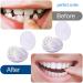 Jiazhou Hub 2 Pairs Prostheses - High-Quality Fake Teeth & Immediate Veneers for a Stunning Smile - Buy Online on GoSupps.com