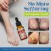 Ingrown Toenail Treatment Oil - Anti Paronychia Relief & Nail Growth Formula - Buy Online on GoSupps.com