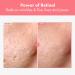 Repair Retinol Cream with Bakuchiol & Niacinamide | Anti-Aging Treatment for Face & Eyes | Korean Skincare 50g - Buy Online on GoSupps.com