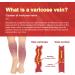 Buy Varicose Vein Plaster | 10 & 12 Piece Venous Stickers for Spider Vein Care | Reduce Appearance of Veins - Buy Online on GoSupps.com