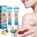 Lipoma Removal Cream Cr me d' limination de lipomes Cellulite Removal Exfoliating Cream Get Rid of Your Fatty Lipoma Lumps (2pcs)