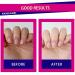 Fandamei Nail Cuticle Oil 2PCS - Nourishing and Moisturizing Cuticle Care Oil with Rose Fragrance - 0.42 oz - Buy Online on GoSupps.com