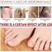 Ingrown Toenail Treatment Nail Helper Nail Growth Treatment Ingrowing Toenail Treatment Ingrown Toenail Corrector Treatment For Ingrown Toenail Ingrowing Toenail Cuticle Oil Nail Growth Treatment - Buy Online on GoSupps.com