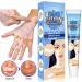 EXQST Vitiligo Care Cream - Targeted Treatment for Even Skin Tone - Buy Online on GoSupps.com