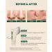KSECRET SEOUL 1988 Cleansing Foam - Pine Cica 1% + Probiotics | 150ml | Best International Shipping - Buy Online on GoSupps.com