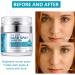 Dark Spot Cream for Face Body Dark Spot Remover Dark Spot Corrector Cream Moisturizes Armpit Neck Knees and Private Parts for All Skin Types - Buy Online on GoSupps.com