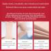 Shop Compression Stockings for Varicose Veins - Open Toe Medium Hose 20-30 mmHg - Comfortable Gradient Compression for Running Cycling Basketball - Flesh & Black Options Available - Buy Online on GoSupps.com