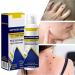 Body Moisturizer - Nourishing and Soothing Mist 60ml | Refreshing and Nourishing Skin Spray | For Men and Women Blemish-Prone Skin Back Shoulders Arms Legs Hands - Buy Online on GoSupps.com