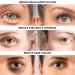 Anti-Aging System Instant Eye Tightener Eye Repair Cream Glycolic Acid 15%. Products in Bundle. Removes Under Eye Bags & Puffiness. Eliminate Dark Circles & Wrinkles. - Buy Online on GoSupps.com
