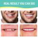Fake Teeth Veneers Dentures Socket - Regain Confident Smile | 1 Pair - Buy Online on GoSupps.com