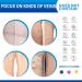 Varicose Veins Cream - Effective Treatment for Leg Relief, Phlebitis & Circulation Improvement (1.7 Fl Oz) - Buy Online on GoSupps.com