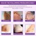 2Pairs Lavender Feet Peeling Socks Foot Moisturiser Socks Foot Masks Remove Hard Skin Callus Remover For Feet Foot Mask For Dry Cracked Feet Exfoliating Foot Peeling Mask For Hard Skin Hand Foot Mask - Buy Online on GoSupps.com