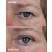 MAGIC Invisible Eyelid Lift Strips (M) - Non-Surgical Adhesive Tape for Drooping Eyelids | 2x60 Pairs Double Pack - Boost Your Eye Appearance! - Buy Online on GoSupps.com