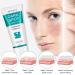 Dark Spot Corrector Cream for Face - Fade Black Precipitates, Remove Freckles & Spots - All Skin Tone Types - Buy Online on GoSupps.com